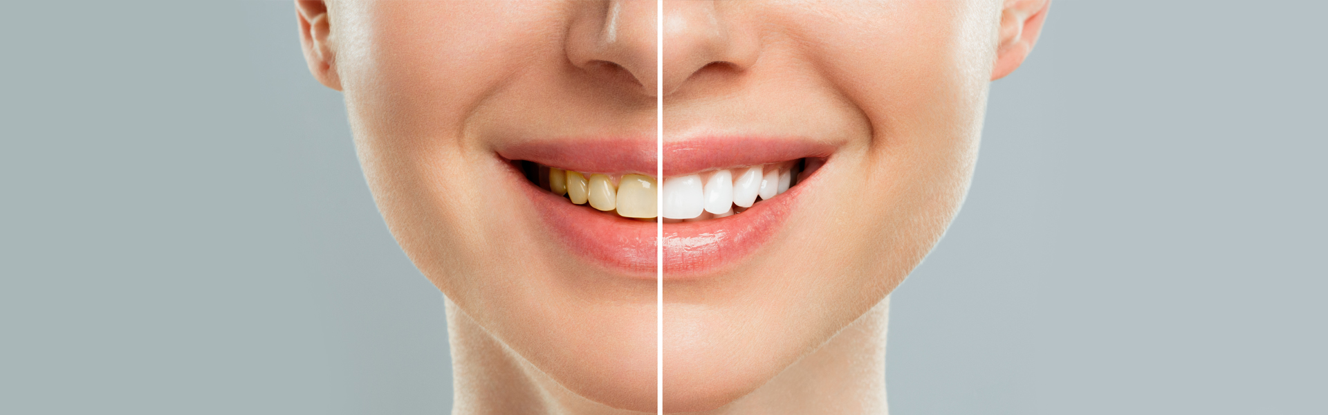 Why Are My Teeth Yellow Despite Brushing Every Day? Common Causes
