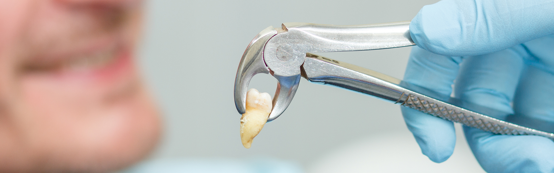 When Will Bleeding Stop After Wisdom Teeth Extraction?