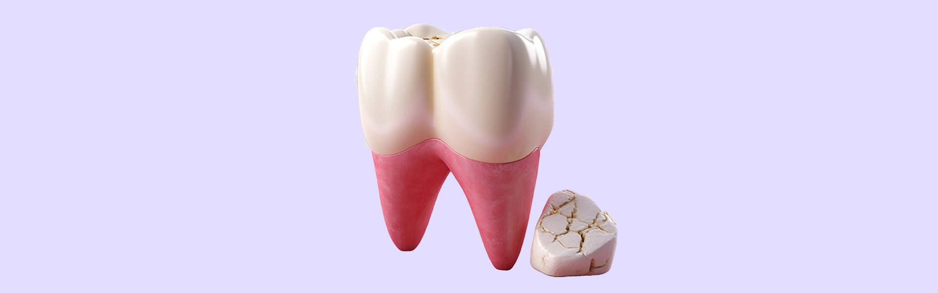 Does a Cracked Tooth Need to Be Pulled? Understanding Your Options