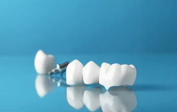 How Dental Crowns Protect Weak Teeth From Further Damage